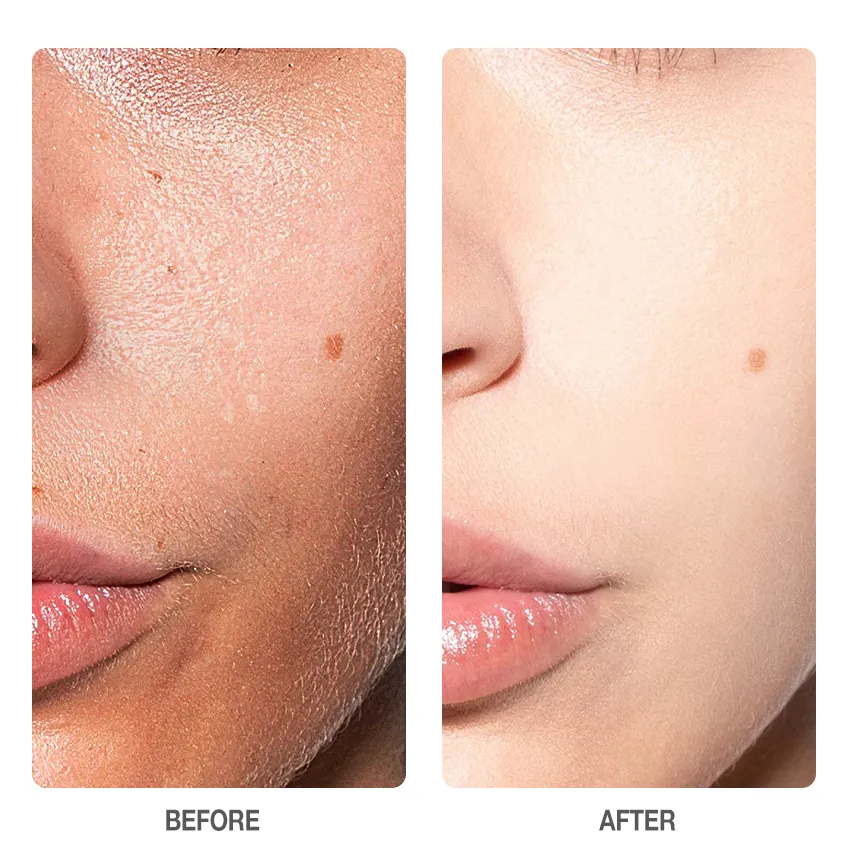 Skinever SALICYLIC ACID Refreshing Scrub Cleanser 75ml - Deep Cleansing Exfoliating Cleanser - ACNE TREATMENT